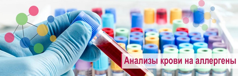 Пробирки для лабораторных анализов