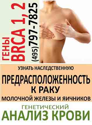     BRCA 1/2,  
