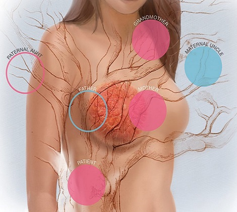 Анализ brca