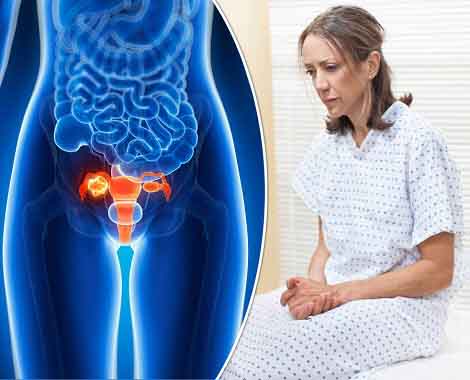 Женщина с мутацией гена BRCA