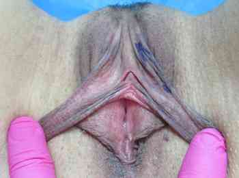 ,  4+  
