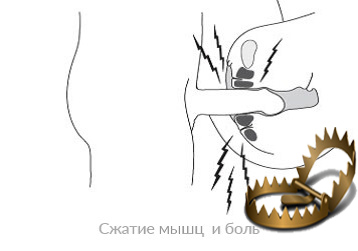 Спазм влагалища во время секса