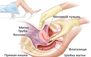 Как проводится влагалищное исследование
